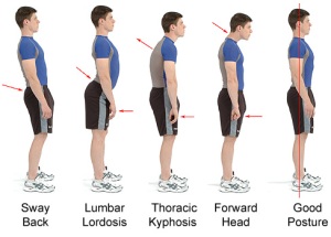 poor-posture-exercises-to-improve